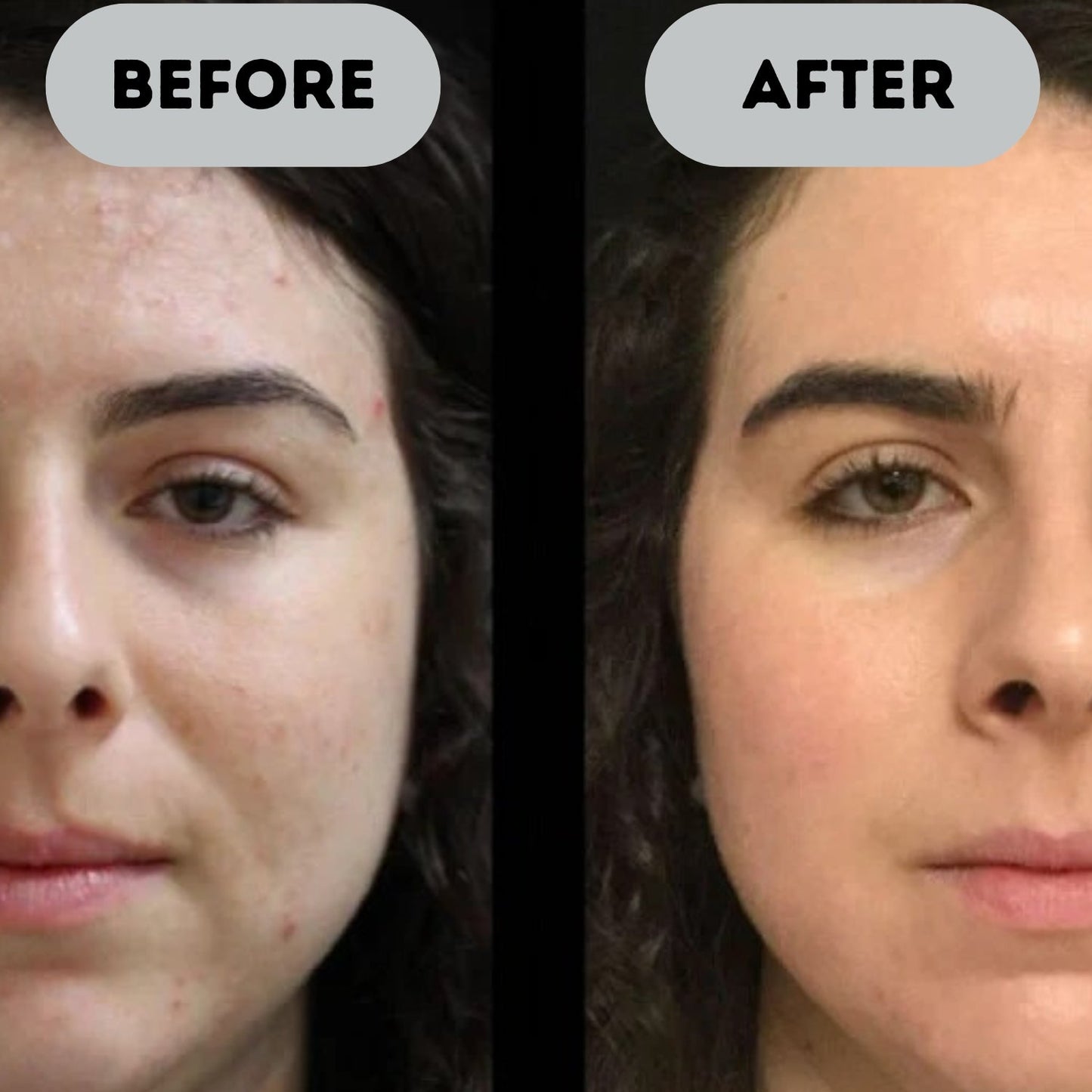 AgeLisse™ - Anti-Aging Booster Pro